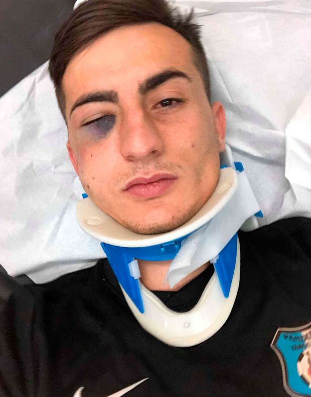 Căpitanul Pandurilor are nevoie de mai multe operații la față