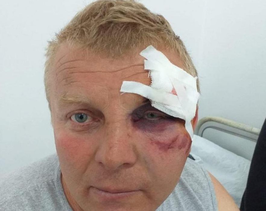 Angajat al CEO, bătut de hoții de fier. Unul dintre agresori e șoferul primarului din Fărcășești