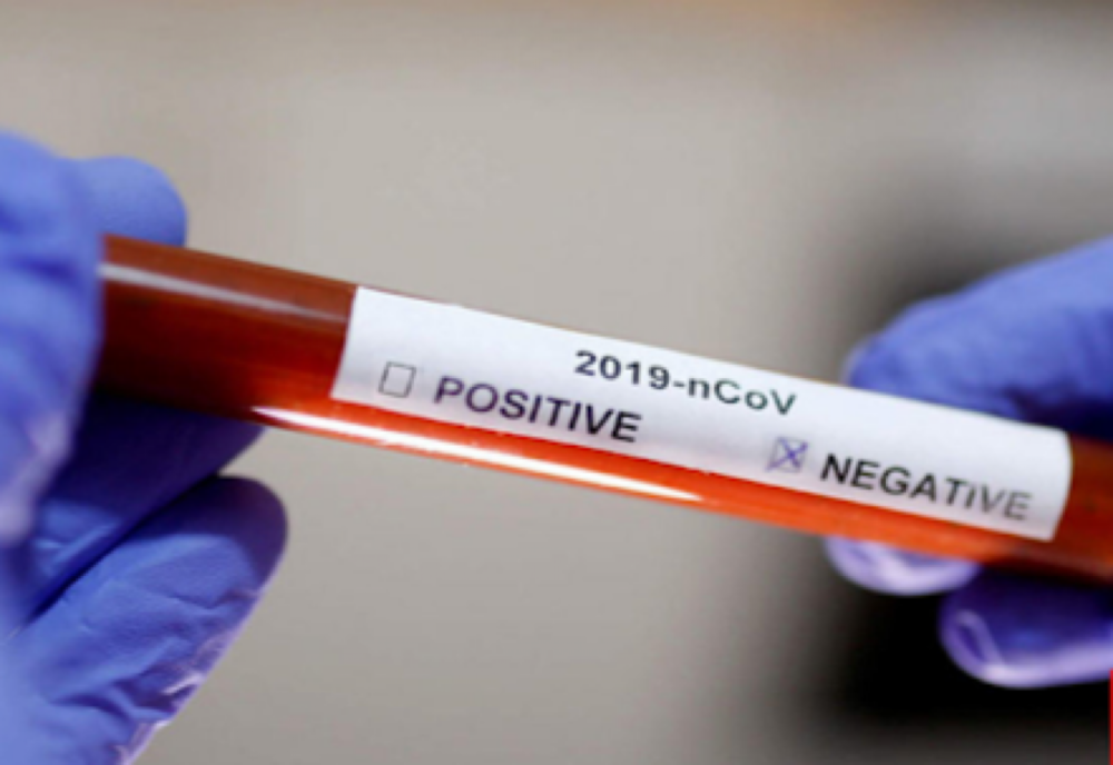 O angajată din cadrul Primăriei Târgu-Cărbuneşti a fost confirmată sâmbătă cu noul coronavirus