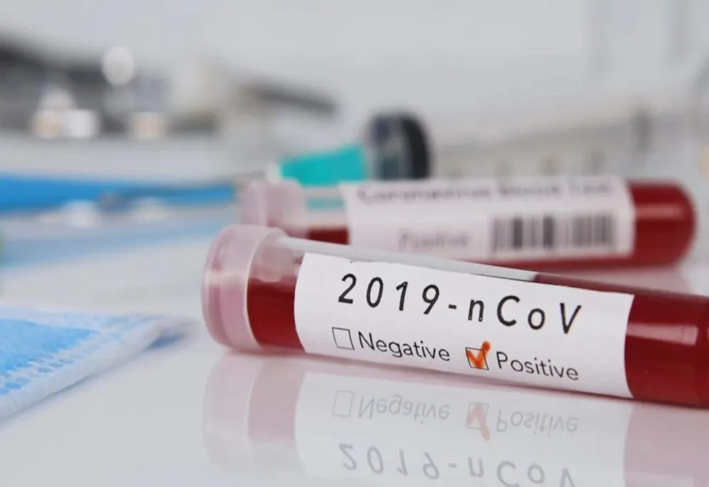 Încă un gorjean cu coronavirus. Cinci cazuri în județ!