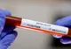 O angajată din cadrul Primăriei Târgu-Cărbuneşti a fost confirmată sâmbătă cu noul coronavirus